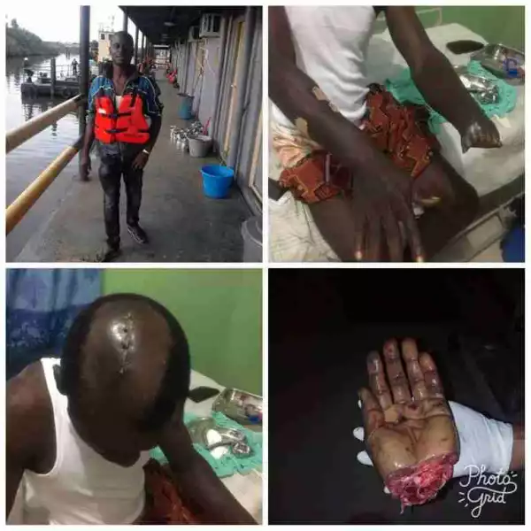 GRAPHIC: Man’s Hand Cut Off, Head Broken After Bloody Attack In Warri